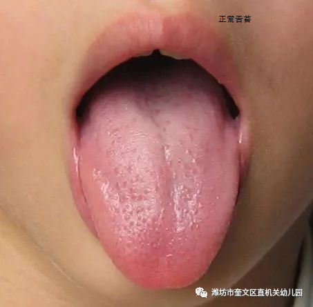 小孩舌苔厚白是怎么回事_厚小孩回事舌苔白是什么原因_厚小孩回事舌苔白是上火吗